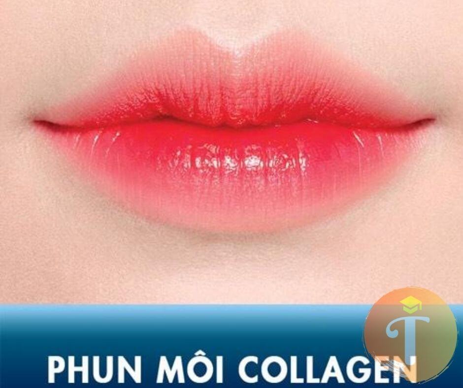 Quá trình phun môi Collagen tại thẩm mỹ viện ngọc dung